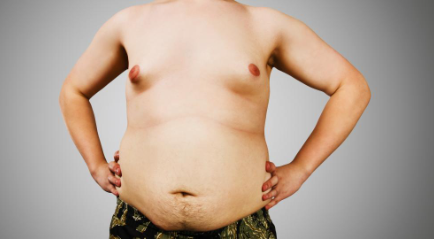 Apa itu Gynecomastia? Penyebab dan Cara Mengobatinya