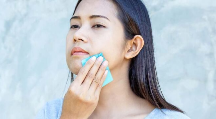 Mencegah Muka Berminyak dengan Suntik Botoks Aman