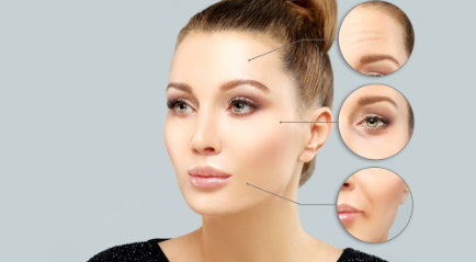 Suntik Botox di Bandung Aman dan Terbaik, Cek Harga dan Lainnya disini!