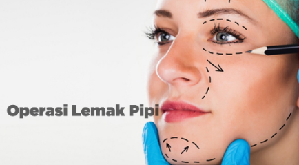 Operasi Lemak Pipi yang Aman dan Terbaik, Sudah Tahu? | Buccal Fat Removal