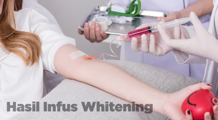 Hasil Infus Whitening yang Mencerahkan Kulit Instant