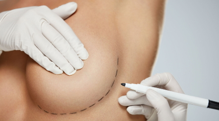 Tempat Breast Implant in Jakarta | The Clinic Beautylosophy