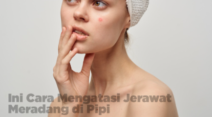 Jerawat Meradang di Pipi Atasi dengan Perawatan Wajah Ini