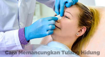 Cara Memancungkan Tulang Hidung dengan Cepat dan Aman