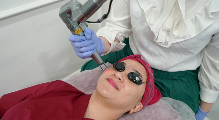 Berapa Biaya Laser Wajah untuk Menghilangkan Flek Hitam? | The Clinic Beautylosophy