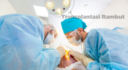 Transplantasi Rambut : Penjelasan, Prosedur, Resiko Hingga Hasil