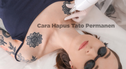 Cara Menghapus Tato Permanen Instan dengan Dokter Spesialis, Nggak Mau Coba?