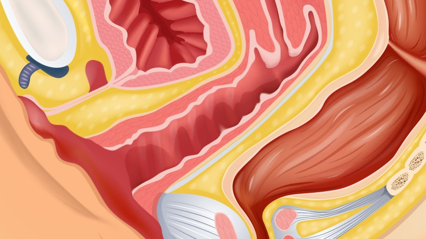 Anal jinsiy aloqa foydalimi yoki zararlimi? Porno jinsiy onlayn Brazzers orgies