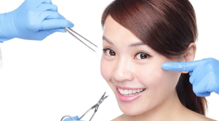 Treatment Wajah di Kelapa Gading dengan Suntik Filler