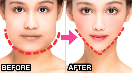 V Shape Face: Treatment untuk Membentuk Wajah "V"