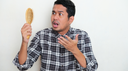 Cara Cepat Menumbuhkan Rambut Botak dalam 1 Minggu